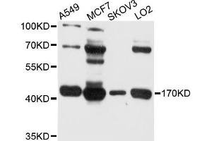 Western blot analysis of extract of various cells, using BDH1 antibody. (BDH1 antibody)