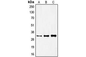 Western blot analysis of FOXR1 expression in HeLa (A), mouse kidney (B), rat kidney (C) whole cell lysates. (FOXR1 antibody  (C-Term))