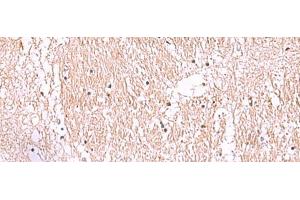 Immunohistochemistry (Paraffin-embedded Sections) (IHC (p)) image for anti-Resistance To Inhibitors of Cholinesterase 8 Homolog A (C. Elegans) (RIC8A) antibody (ABIN7247147)
