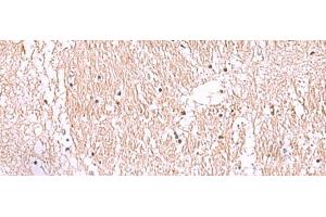 Immunohistochemistry of paraffin-embedded Human brain tissue using RIC8A Polyclonal Antibody at dilution of 1:55(x200)