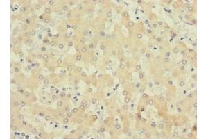 Immunohistochemistry of paraffin-embedded human liver tissue using ABIN7174246 at dilution of 1:100 (COQ4 antibody  (AA 31-265))