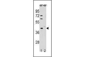 Western blot analysis of STK25 Antibody (C-term) Pab (ABIN1881851 and ABIN2843256) pre-incubated without(lane 1) and with(lane 2) blocking peptide in A549 cell line lysate.