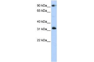 WB Suggested Anti-CCDC69 Antibody Titration: 0. (CCDC69 antibody  (Middle Region))