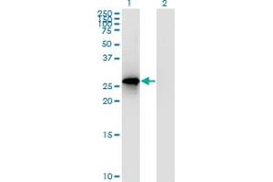 Western Blot analysis of RPP30 expression in transfected 293T cell line by RPP30 polyclonal antibody (A01). (RPP30 antibody  (AA 169-268))