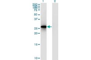Western Blot analysis of RPP30 expression in transfected 293T cell line by RPP30 polyclonal antibody (A01). (RPP30 antibody  (AA 169-268))