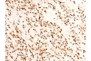 Immunohistochemistry (IHC) image for anti-Jun Proto-Oncogene (JUN) (pThr91) antibody (ABIN6256604)