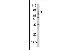 Image no. 1 for anti-Death-Domain Associated Protein (DAXX) (pSer213) antibody (ABIN358116) (DAXX antibody  (pSer213))