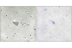 Immunohistochemistry analysis of paraffin-embedded human brain tissue, using ARMX3 Antibody. (ARMCX3 antibody  (AA 291-340))