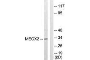 Western blot analysis of extracts from COLO205 cells, using MEOX2 Antibody. (MEOX2 antibody  (AA 151-200))