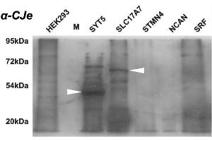 Western blot analysis of the cross-reactivity of antibodies directed against Campylobacter jejuni with different protein samples as provided by commercial HEK-293 overexpression lysates. (Campylobacter jejuni antibody)