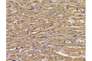 ABIN7095188 and ABIN7099244 at 1/100 staining rat heart tissue by IHC-P. (CLIC5 antibody)