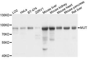 Western blot analysis of extracts of various cell lines, using MUT antibody. (MUT antibody  (AA 451-750))