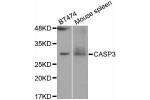 Western blot analysis of extracts of various cell lines, using CASP3 antibody. (Caspase 3 antibody)