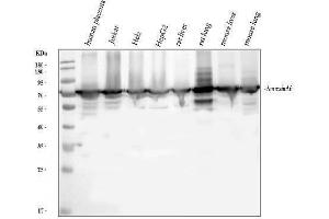 Western blot analysis of Annexin VI/ANXA6 using anti-Annexin VI/ANXA6 antibody (ABIN5692982). (ANXA6 antibody  (AA 395-665))