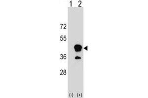 Western blot analysis of CD1b antibody and 293 cell lysate (2 ug/lane) either nontransfected (Lane 1) or transiently transfected (2) with the CD1B gene.