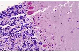 Human Brain, Cerebellum: Formalin-Fixed, Paraffin-Embedded (FFPE) (CXCR7 antibody  (AA 311-360))