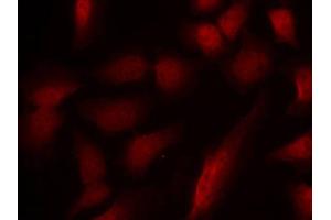 Immunofluorescence staining of methanol-fixed HeLa cells using Phospho-GATA1-S310 antibody (ABIN2988025). (GATA1 antibody  (pSer310))