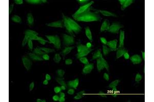 Immunofluorescence of monoclonal antibody to FHL5 on HepG2 cell. (FHL5 antibody  (AA 1-284))