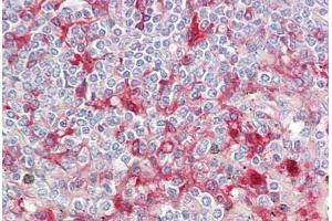Anti-ORM1 / Orosomucoid antibody IHC staining of human spleen. (ORM1 antibody)