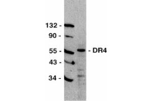 Image no. 1 for anti-Tumor Necrosis Factor Receptor Superfamily, Member 10a (TNFRSF10A) (C-Term) antibody (ABIN201644)