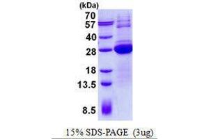 Figure annotation denotes ug of protein loaded and % gel used.