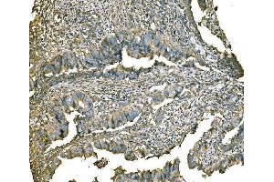 IHC analysis of PKM2 using anti-PKM2 antibody (ABIN3043381).