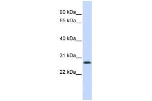 WB Suggested Anti-LSM12 Antibody Titration: 0. (LSM12B antibody  (Middle Region))