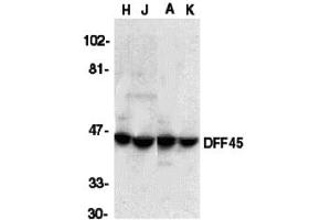 Western Blotting (WB) image for anti-DNA Fragmentation Factor, 45kDa, alpha Polypeptide (DFFA) (C-Term) antibody (ABIN1030360) (DFFA antibody  (C-Term))