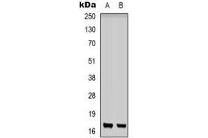 Western blot analysis of CD225 expression in K562 (A), PC12 (B) whole cell lysates. (IFITM1 antibody  (N-Term))