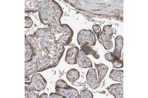 Immunohistochemical staining of human placenta with GALNTL6 polyclonal antibody  shows moderate cytoplasmic positivity in trophoblastic cells. (GALNTL6 antibody)