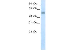 Western Blotting (WB) image for anti-Methyltransferase Like 3 (METTL3) antibody (ABIN2461900) (METTL3 antibody)