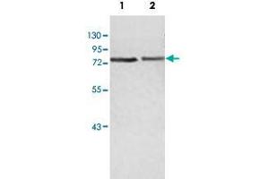 Western blot analysis of human fetal heart (Lane 1) and fetal brain (Lane 2) lysate with ZBED5 polyclonal antibody  at 1 : 500 dilution. (ZBED5 antibody  (AA 224-474))