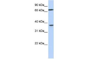 WB Suggested Anti-MAP2K3 Antibody Titration:  0. (MAP2K3 antibody  (C-Term))