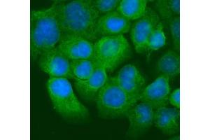 IF analysis of Krt20 using anti-Krt20 antibody (ABIN7601133). (KRT20 antibody  (AA 29-431))