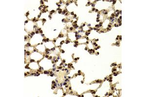 Immunohistochemistry of paraffin-embedded mouse lung using AAAS Antibody (ABIN5973827) at dilution of 1/100 (40x lens).