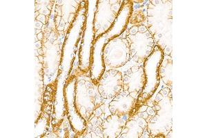 Immunohistochemistry analysis of paraffin-embedded mouse kidney using,Cadherin 16 (ABIN7073265) at dilution of 1: 2000 (Cadherin-16 antibody)