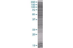 CIDEA transfected lysate. (CIDEA 293T Cell Transient Overexpression Lysate(Denatured))