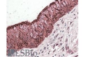 ABIN571182 (3. (ALDH3A1 antibody  (C-Term))
