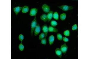 IF analysis of KIF2A using anti-KIF2A antibody (ABIN7600510). (KIF2A antibody  (AA 2-706))