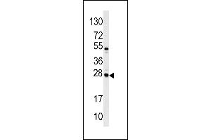 Western blot analysis of CASA antibody (Center) (ABIN390465 and ABIN2840834) in Jurkat cell line lysates (35 μg/lane). (Casein alpha S1 antibody  (AA 42-70))