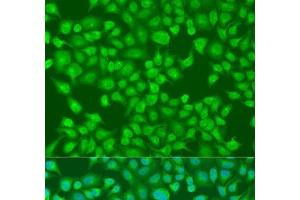 Immunofluorescence analysis of U2OS cells using ACOX1 Polyclonal Antibody at dilution of 1:100. (ACOX1 antibody)