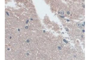 Detection of NLRP3 in Mouse Cerebrum Tissue using Polyclonal Antibody to NLR Family, Pyrin Domain Containing Protein 3 (NLRP3)