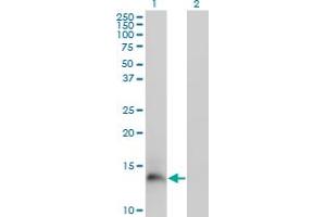 Western Blot analysis of PI3 expression in transfected 293T cell line by PI3 monoclonal antibody (M02), clone 2G20. (PI3 antibody  (AA 1-117))