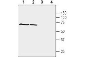 Western Blotting (WB) image for anti-Syntrophin, beta 1 (Dystrophin-Associated Protein A1, 59kDa, Basic Component 1) (SNTB1) (AA 99-113), (Intracellular) antibody (ABIN7043798)