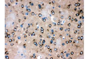 Anti- ROCK2 Picoband antibody,IHC(P) IHC(P): Rat Brain Tissue (ROCK2 antibody  (AA 652-923))