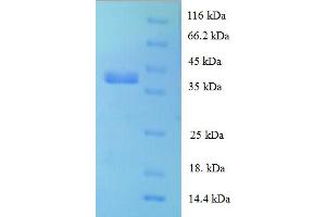 RPL28 Protein (AA 2-137) (GST tag)
