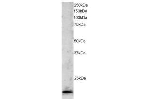 Image no. 1 for anti-Telomeric Repeat Binding Factor 2 (TERF2) (C-Term) antibody (ABIN374265)
