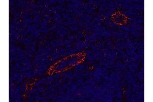 Indirect immunostaining of formalin-fixed paraffin embedded human tonsil section (dilution 1 : 200). (CD31 antibody)