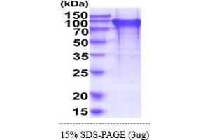 SDS-PAGE (SDS) image for Bridging Integrator 2 (BIN2) (AA 1-597) protein (His tag) (ABIN6388106) (BIN2 Protein (AA 1-597) (His tag))