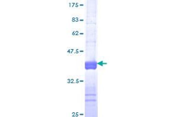 FMR1 Protein (AA 121-220) (GST tag)